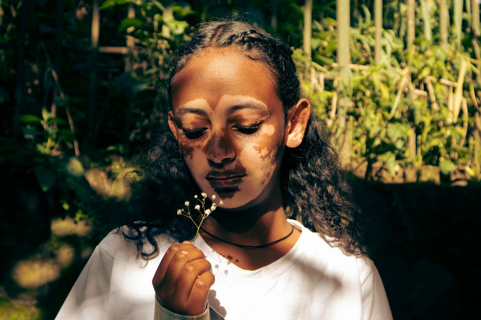 A young Ethiopian woman with vitiligo holds a small flower outdoors, expressing self-reflection.